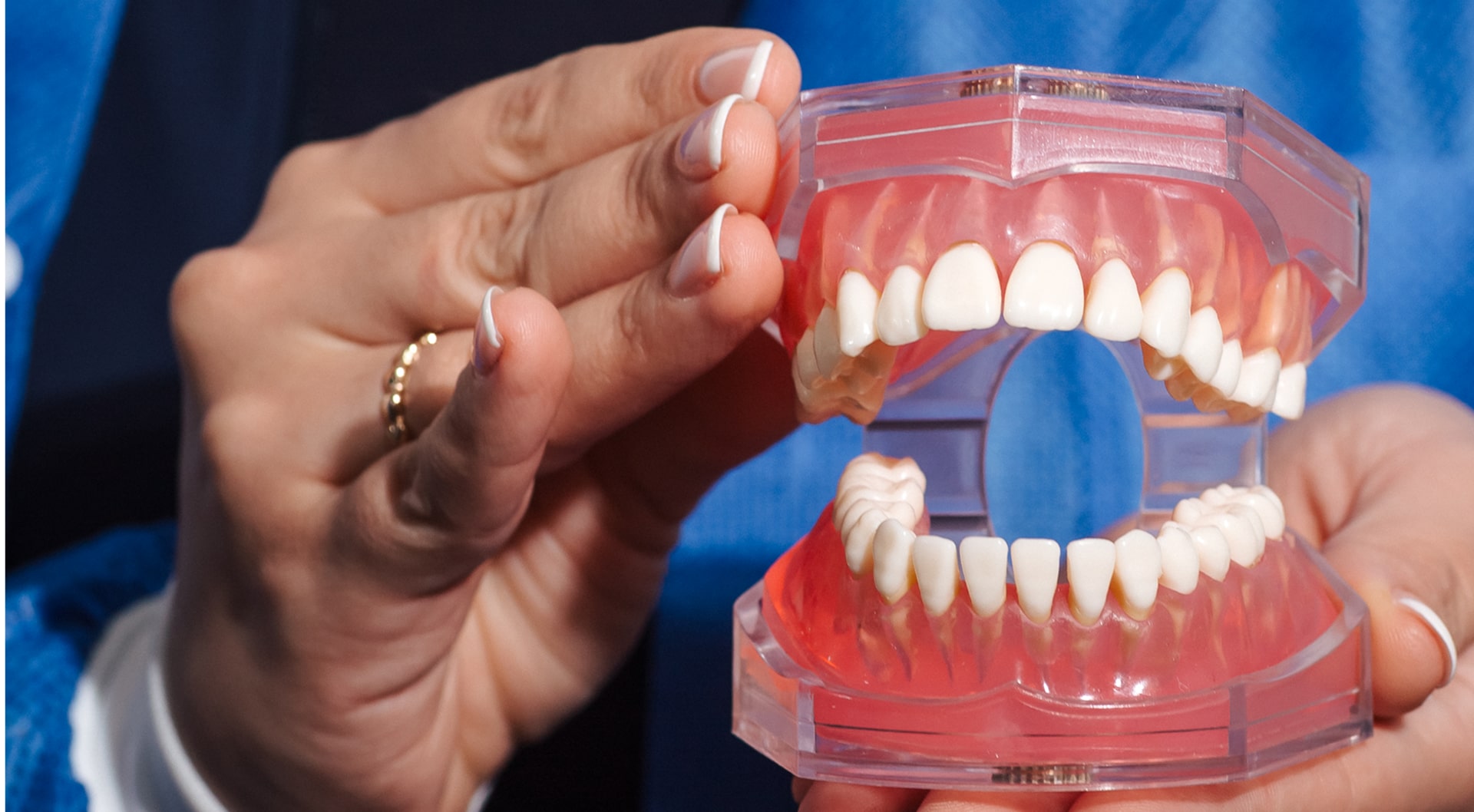 A model of a jaw